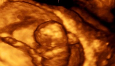 Ultrasonografia - wskazania i przygotowanie do badania