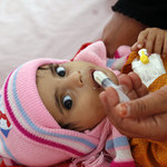 Umierający Jemen. Głodują miliony dzieci 
