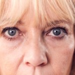 Unieś opadające powieki mikroprądami. Odmień spojrzenie po 4 zabiegach