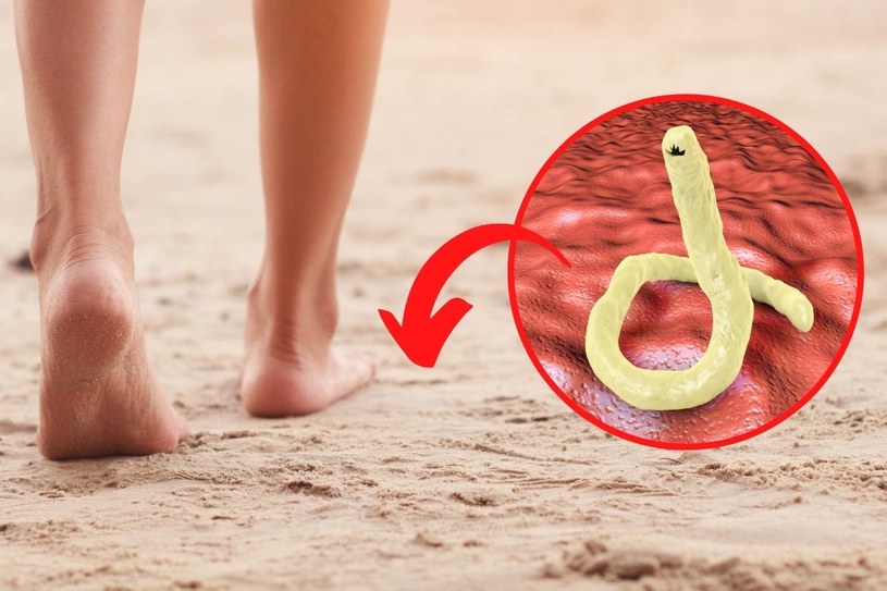 Unikaj chodzenia boso po plaży. Odradza się też leżenia i siedzenia na gołym piasku /123RF/PICSEL