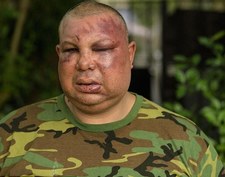 ​USA: Policjanci ciężko pobili Latynosa. "Nie jesteś prawdziwym Amerykaninem"
