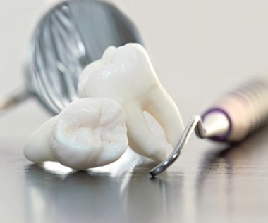 Usuwanie zębów mądrości to największe dentystyczne oszustwo?