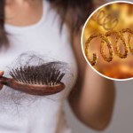 wypadanie włosów powody Utrata włosów wynika nie tylko ze złej diety. To może być objaw choroby