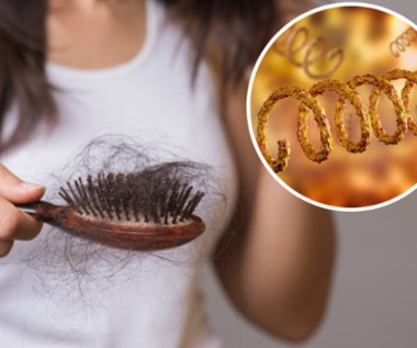 Utrata włosów wynika nie tylko ze złej diety. To może być objaw choroby