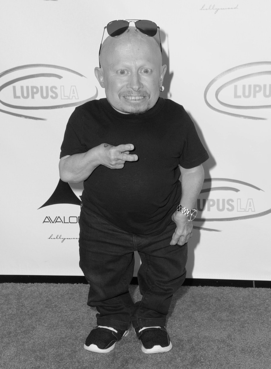 Verne Troyer /Birdie Thompson /PAP/EPA