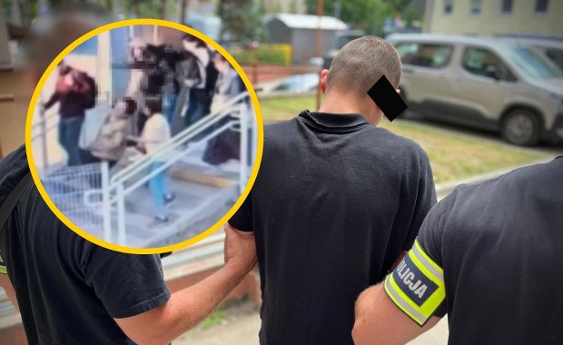 W biały dzień kopnął kobietę w głowę. Szokujący atak w Łodzi