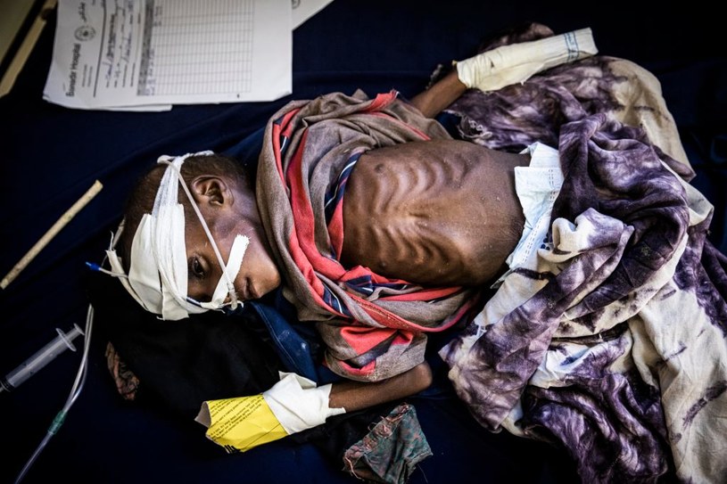 W całej Somalii panuje głód /Getty Images