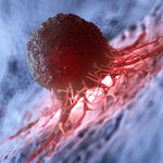 W komórkach nowotworowych żyją bakterie