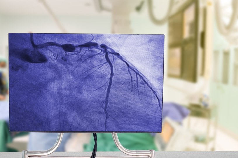 W koronografii do tętnicy wprowadza się cewnik, przez który lekarz podaje kontrast, a następnie wykonuje się zdjęcia rentgenowskie /123RF/PICSEL