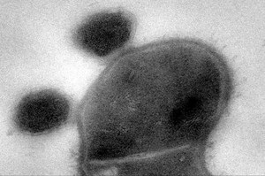 W ludzkiej ślinie odkryto nieznany wcześniej szczep bakterii