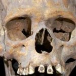 W Meksyku znaleziono szkielet inkrustowany kamieniami w zębach
