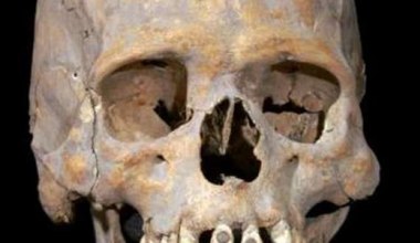 W Meksyku znaleziono szkielet inkrustowany kamieniami w zębach