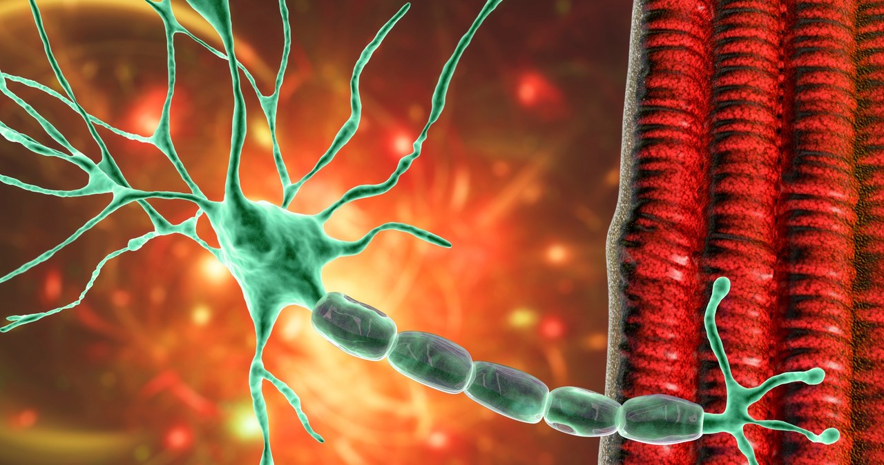 W miastenii, w wyniku zakłócenia transmisji sygnału nerw-mięśnie, dochodzi do osłabienia mięśni /123RF/PICSEL
