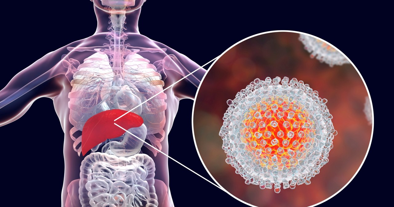 W Polsce liczbę zakażonych wirusem HCV szacuje się na ok. 150 tys.; większość nie zdaje sobie z tego sprawy /123RF/PICSEL