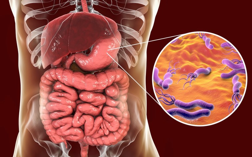W Polsce szacuje się, że nawet 80 proc. osób dorosłych zakażonych jest bakterią H. pylori, jednak objawy występują tylko u co piątej osoby /123RF/PICSEL