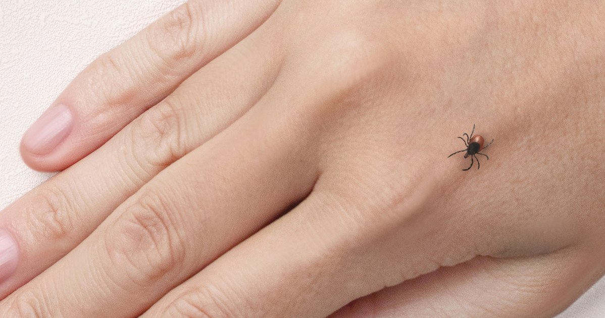 W przypadku boreliozy nie zaleca się antybiotykoterapii trwającej dłużej niż 28 dni /123RF/PICSEL