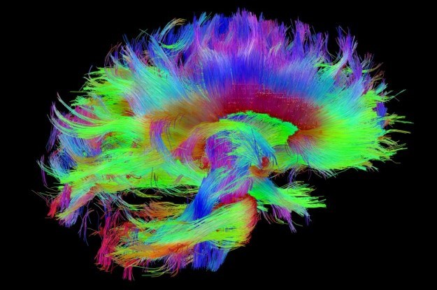 W ramach programu Human Connectome Project Amerykanie stworzą najdokładniejszą mapę ludzkiego mózgu /materiały prasowe