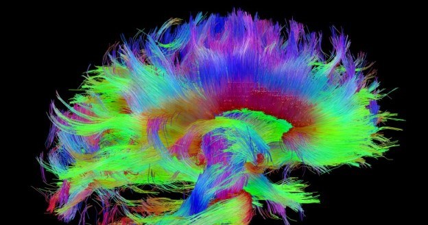 W ramach programu Human Connectome Project Amerykanie stworzą najdokładniejszą mapę ludzkiego mózgu /materiały prasowe