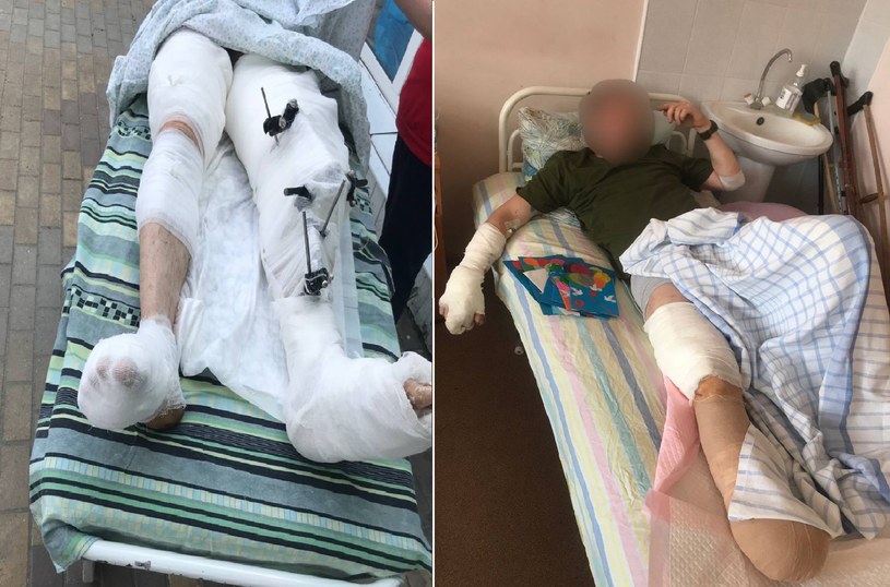 W rosyjskich szpitalach dla rannych w wojnie z Ukrainą brakuje wszystkiego - amputacje kończyn są przeprowadzane bez środków znieczulających /Twitter
