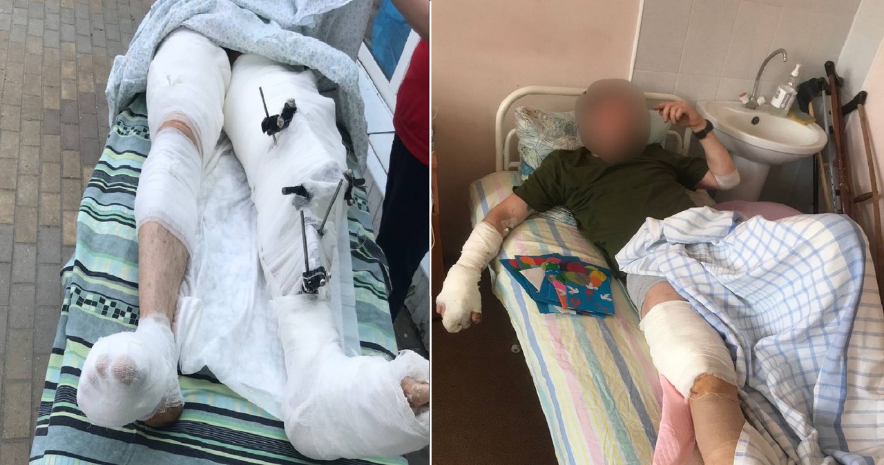 W rosyjskich szpitalach dla rannych w wojnie z Ukrainą brakuje wszystkiego - amputacje kończyn są przeprowadzane bez środków znieczulających /Twitter