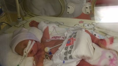 W Rudzie Śląskiej urodziły się czworaczki