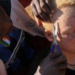 W Tanzanii zakazali czarów. Chcą obronić albinosów