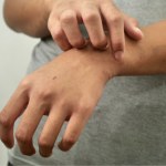 W ten sposób wątroba wysyła ci sygnał SOS. Zauważysz na skórze