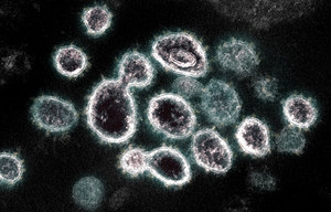 W USA i Australii zidentyfikowano nowe, niebezpieczne podwarianty koronawirusa