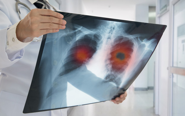 W Wielkopolsce spadła liczba pacjentów podejmujących leczenie onkologiczne /Shutterstock