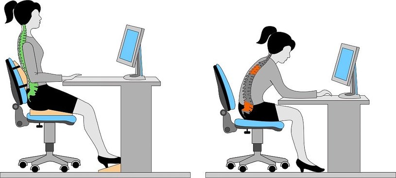 дефекты осанки / © Photogenica