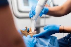"Wampiry" z Gliwic przebadane. Dentyści nie pozostawiają złudzeń w sprawie znaleziska 