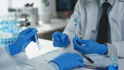 Wczesne wykrycie raka trzustki w końcu możliwe? Przełomowe odkrycie