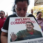 Według brata Chaveza jego stan poprawia się
