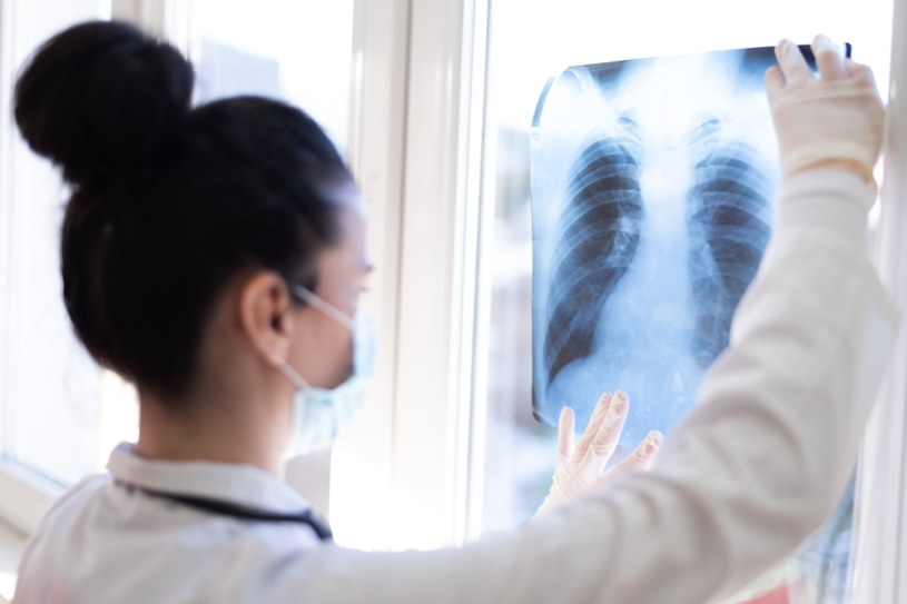 Według danych z 2020 roku na świecie pojawiło się aż 2,2 miliony nowych przypadków raka płuc