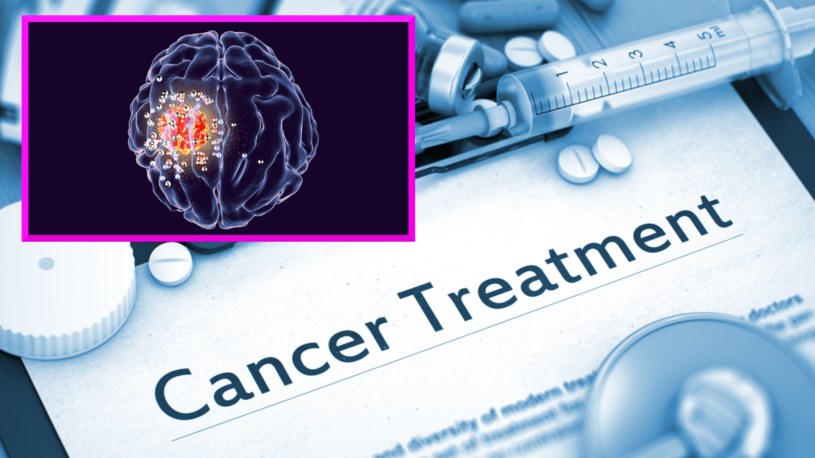 Według naukowców z Uniwersytetu Stanforda niedługo będzie można leczyć raka mózgu z zacisza własnego domu /123RF/PICSEL