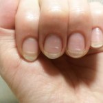 Weź z kuchni i natrzyj paznokcie. Pozbędziesz się przebarwień 