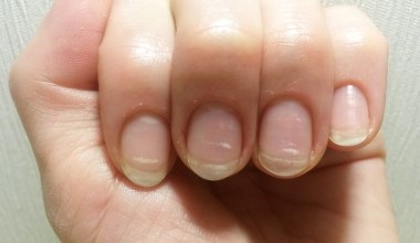 Weź z kuchni i natrzyj paznokcie. Pozbędziesz się przebarwień 