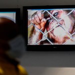 WHO: 780 przypadków małpiej ospy poza Afryką