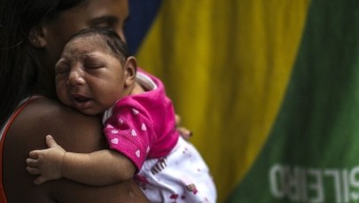 Wiadomo już, jak wirus Zika może wywoływać małogłowie