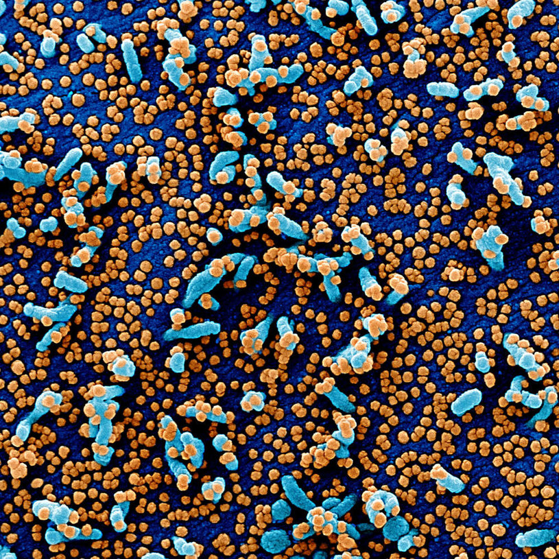 Większe zdjęcie - SARS-CoV-2 (żółte punkty) fot. National Institute of Allergy and Infectious Diseases (NIAID) /materiały prasowe