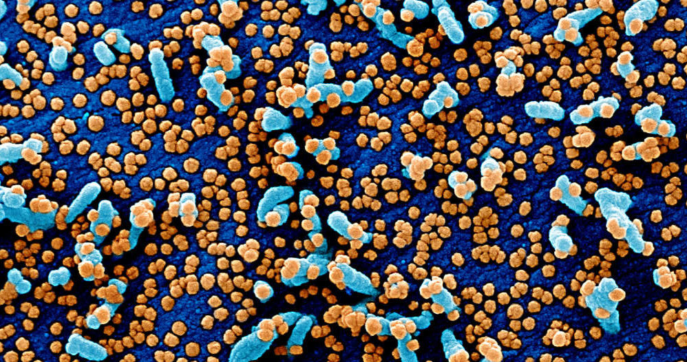 Większe zdjęcie - SARS-CoV-2 (żółte punkty) fot. National Institute of Allergy and Infectious Diseases (NIAID) /materiały prasowe