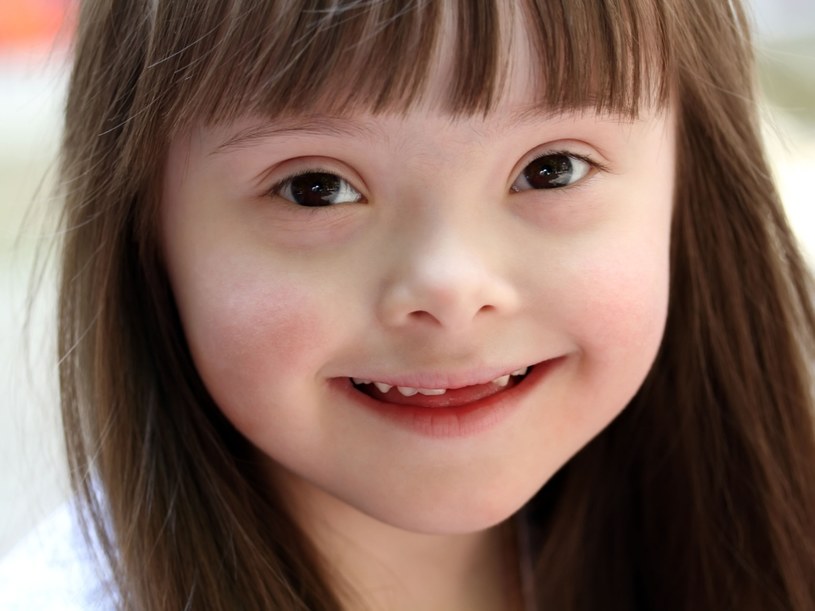 Wiele dzieci i dorosłych z zespołem Downa nigdy nie będzie wymagać specjalistycznego leczenia /123RF/PICSEL