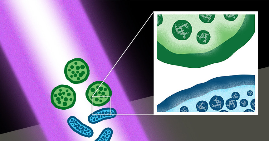 Wielolekooporne bakterie i ich przetrwalniki mogą być zabijane przez lasery o ultrakrótkich impulsach /materiały prasowe