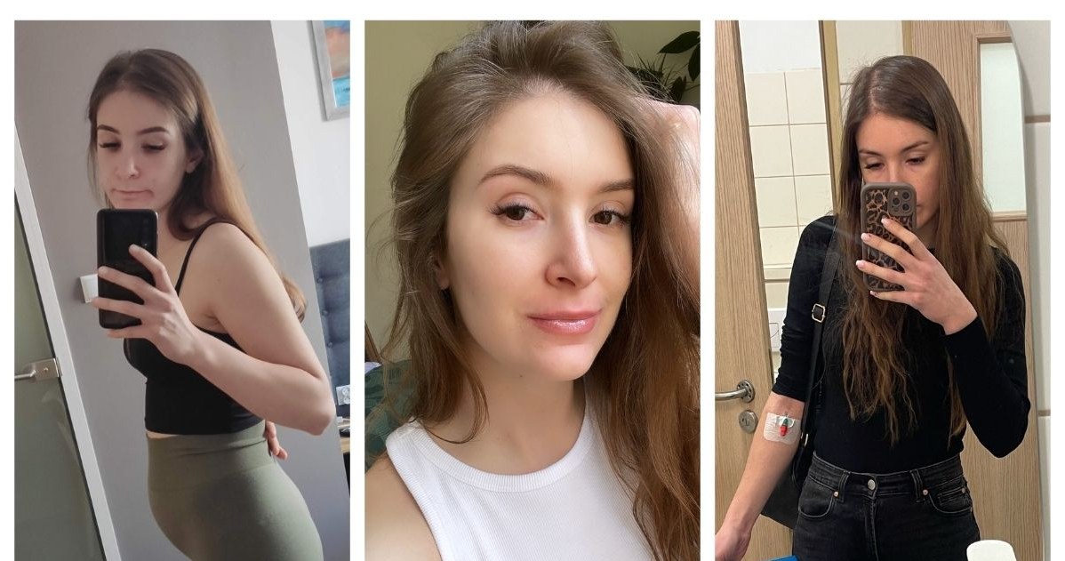 Wiktoria Karabin od kilku lat zmaga się z chorobą Leśniowskiego-Crohna i łysieniem plackowatym /archiwum prywatne