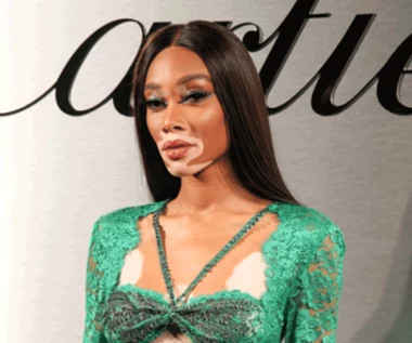 Winnie Harlow jak szmaragd