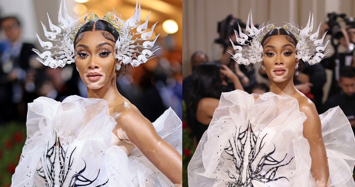 Winnie Harlow /Kevin Mazur /Getty Images