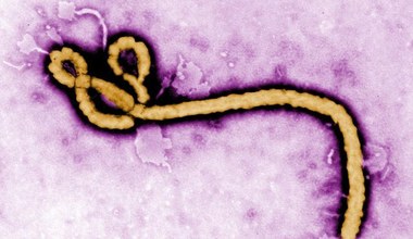 Wirus Ebola może ukrywać się w mózgu i ponownie atakować