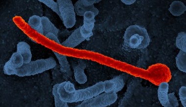 Wirus Ebola może ukrywać się w organizmie nawet pięć lat