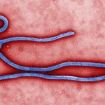 Wirus Ebola - najgroźniejszy zabójca na Ziemi
