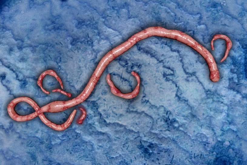 Wirus Ebola powodujący gorączkę krwotoczną /123RF/PICSEL